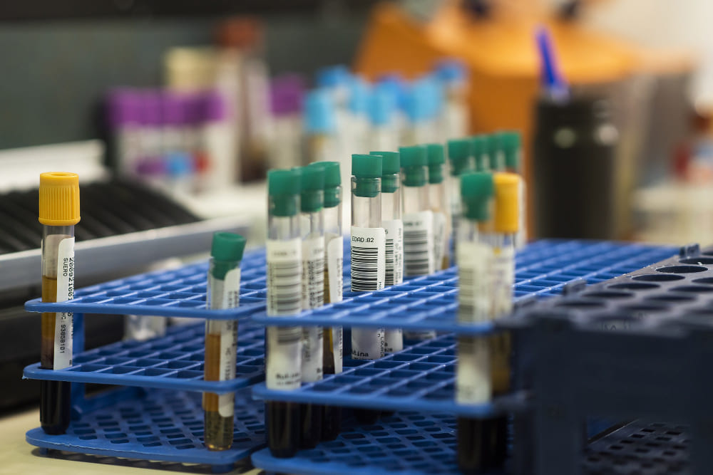 Equipamentos de Laboratório Clínico: principais modelos e usos
